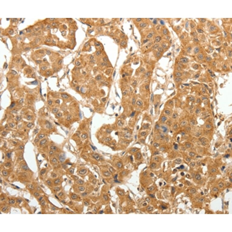 Immunohistochemistry - MAP1B Antibody from Signalway Antibody (37266) - Antibodies.com