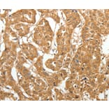 Immunohistochemistry - MAP1B Antibody from Signalway Antibody (37266) - Antibodies.com