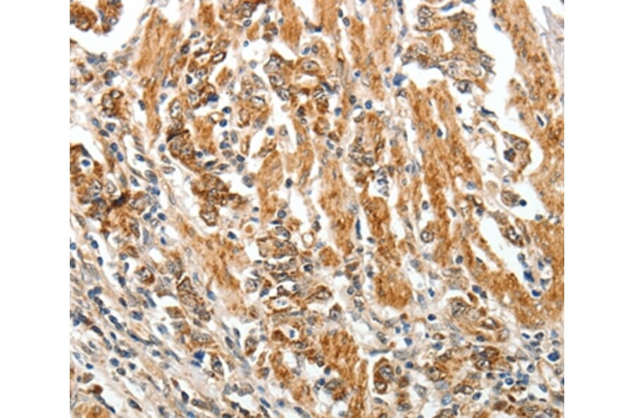 Immunohistochemistry - TGFBR1 Antibody from Signalway Antibody (37272) - Antibodies.com