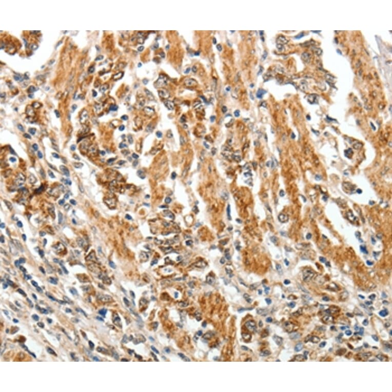 Immunohistochemistry - TGFBR1 Antibody from Signalway Antibody (37272) - Antibodies.com