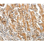 Immunohistochemistry - TGFBR1 Antibody from Signalway Antibody (37272) - Antibodies.com