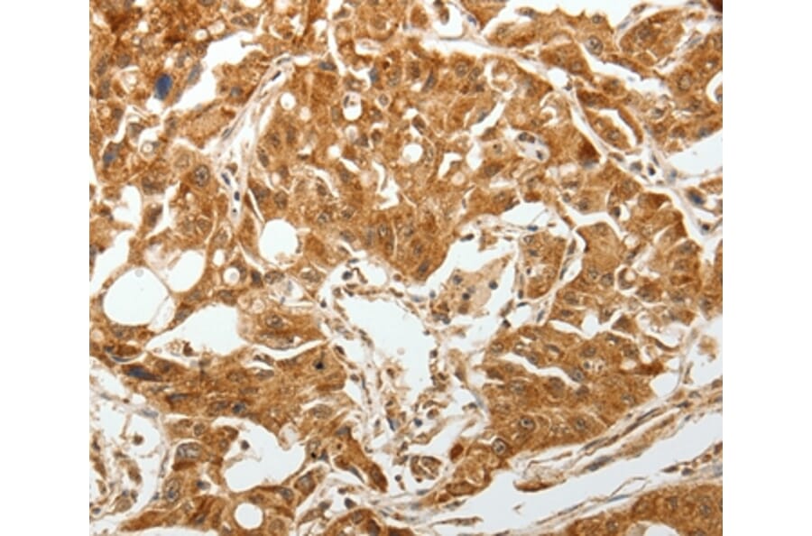 Immunohistochemistry - TGFBR1 Antibody from Signalway Antibody (37272) - Antibodies.com