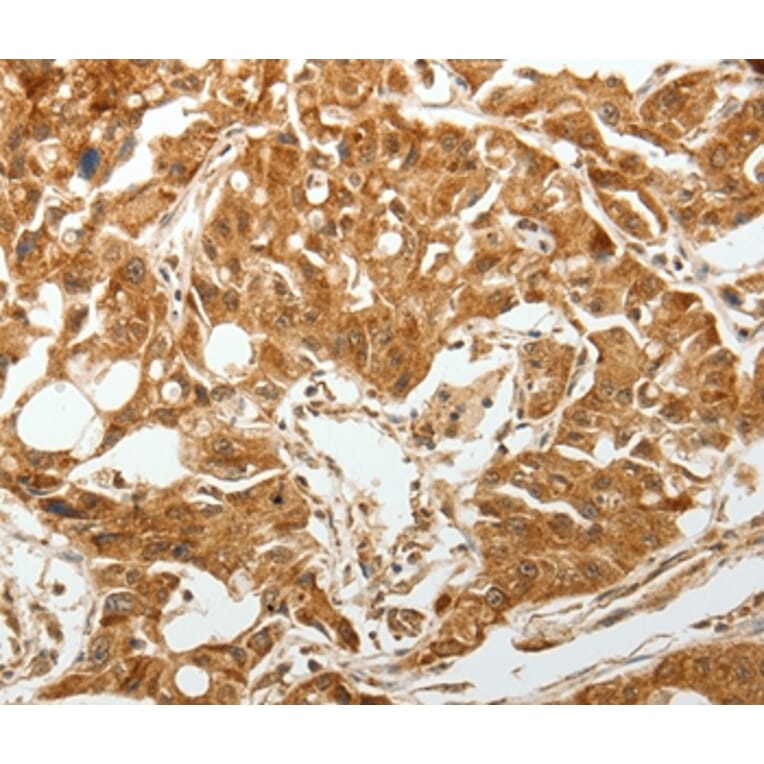 Immunohistochemistry - TGFBR1 Antibody from Signalway Antibody (37272) - Antibodies.com