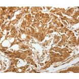 Immunohistochemistry - TGFBR1 Antibody from Signalway Antibody (37272) - Antibodies.com