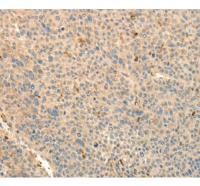 Immunohistochemistry - TMSB4X Antibody from Signalway Antibody (37278) - Antibodies.com