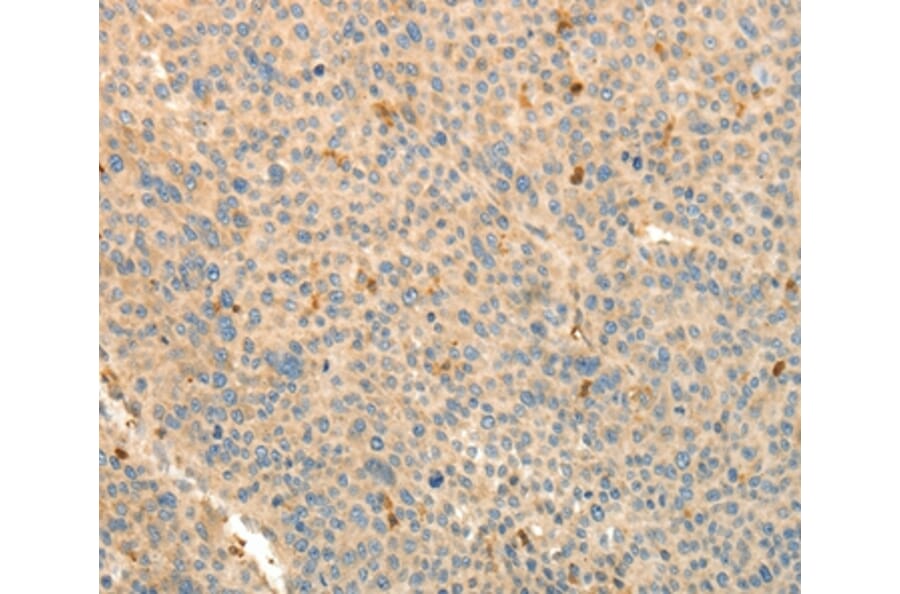 Immunohistochemistry - TMSB4X Antibody from Signalway Antibody (37278) - Antibodies.com