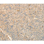 Immunohistochemistry - TMSB4X Antibody from Signalway Antibody (37278) - Antibodies.com