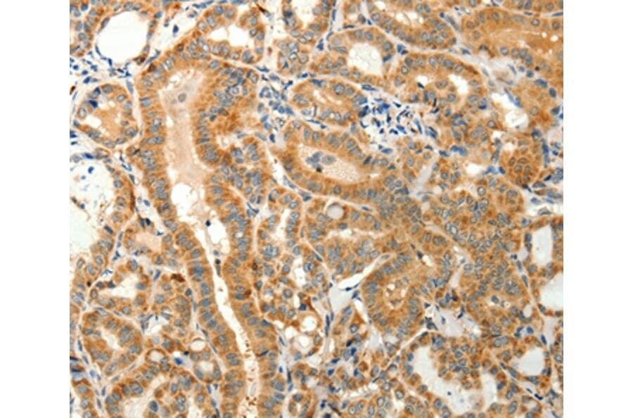 Immunohistochemistry - TMSB4X Antibody from Signalway Antibody (37278) - Antibodies.com