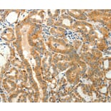 Immunohistochemistry - TMSB4X Antibody from Signalway Antibody (37278) - Antibodies.com