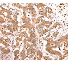 Immunohistochemistry - CELSR2 Antibody from Signalway Antibody (37302) - Antibodies.com