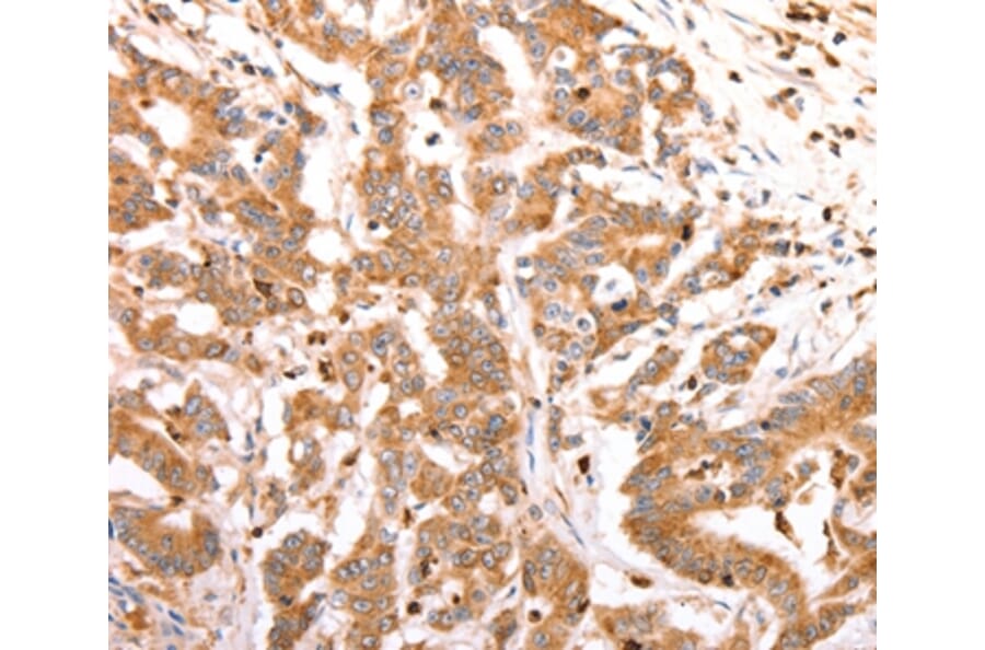 Immunohistochemistry - CELSR2 Antibody from Signalway Antibody (37302) - Antibodies.com