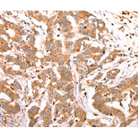 Immunohistochemistry - CELSR2 Antibody from Signalway Antibody (37302) - Antibodies.com