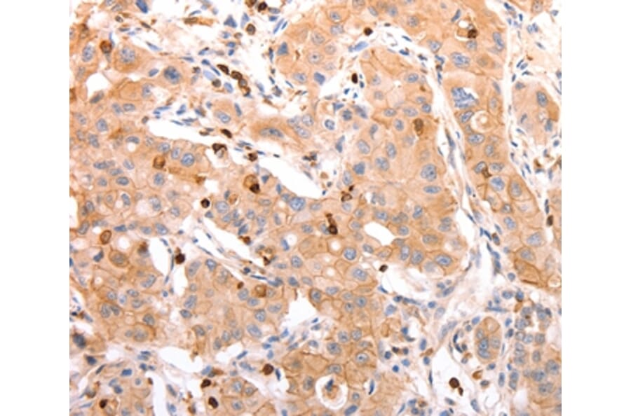 Immunohistochemistry - CELSR2 Antibody from Signalway Antibody (37302) - Antibodies.com