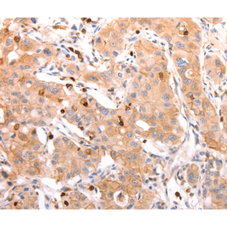 Immunohistochemistry - CELSR2 Antibody from Signalway Antibody (37302) - Antibodies.com