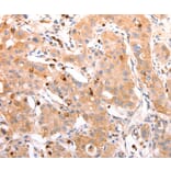 Immunohistochemistry - CELSR2 Antibody from Signalway Antibody (37302) - Antibodies.com