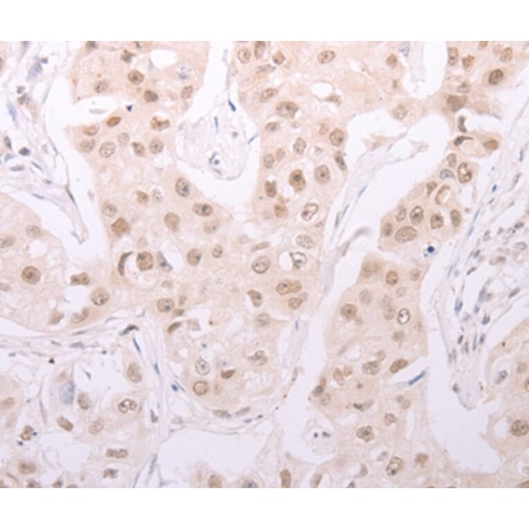 Immunohistochemistry - ADAM12 Antibody from Signalway Antibody (37309) - Antibodies.com