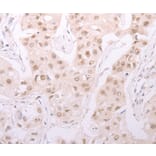 Immunohistochemistry - ADAM12 Antibody from Signalway Antibody (37309) - Antibodies.com