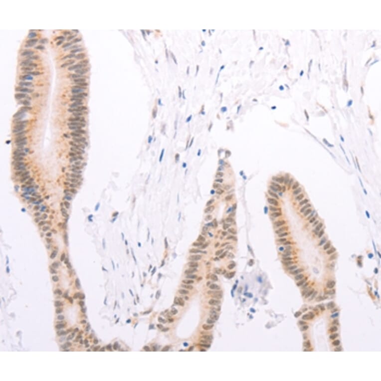 Immunohistochemistry - ADAM12 Antibody from Signalway Antibody (37309) - Antibodies.com