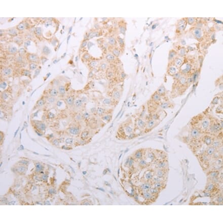 Immunohistochemistry - ADAM28 Antibody from Signalway Antibody (37311) - Antibodies.com