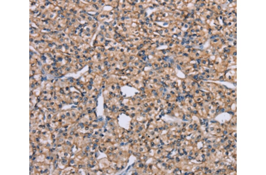 Immunohistochemistry - ADAM29 Antibody from Signalway Antibody (37312) - Antibodies.com