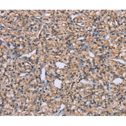 Immunohistochemistry - ADAM29 Antibody from Signalway Antibody (37312) - Antibodies.com