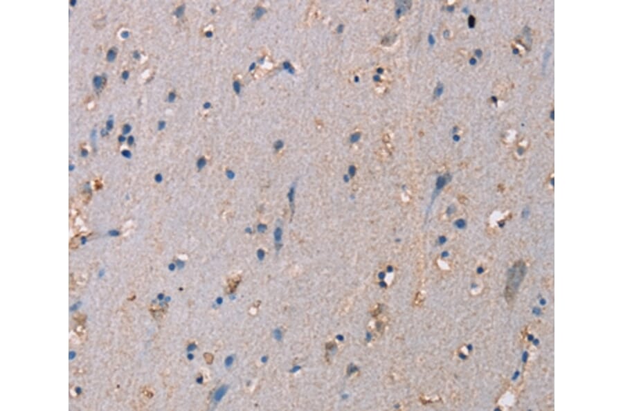 Immunohistochemistry - ADAM29 Antibody from Signalway Antibody (37312) - Antibodies.com