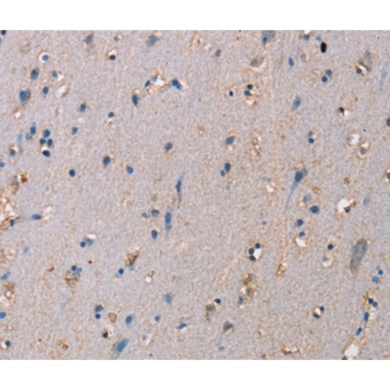Immunohistochemistry - ADAM29 Antibody from Signalway Antibody (37312) - Antibodies.com