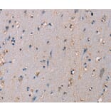 Immunohistochemistry - ADAM29 Antibody from Signalway Antibody (37312) - Antibodies.com