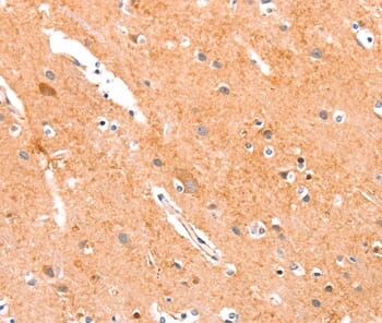 Immunohistochemical analysis of paraffin-embedded Human brain tissue using #37332 at dilution 1/35.