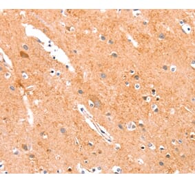 Immunohistochemistry - ANKZF1 Antibody from Signalway Antibody (37332) - Antibodies.com