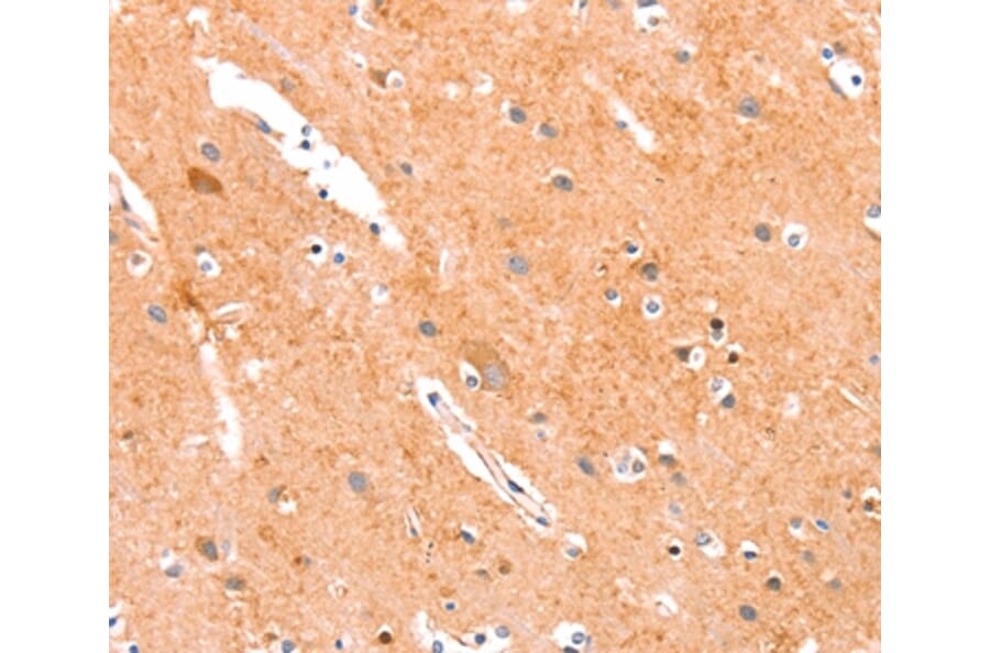 Immunohistochemistry - ANKZF1 Antibody from Signalway Antibody (37332) - Antibodies.com