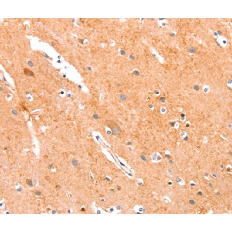 Immunohistochemistry - ANKZF1 Antibody from Signalway Antibody (37332) - Antibodies.com