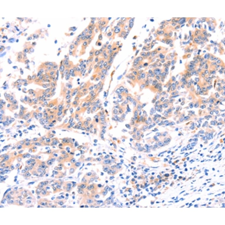 Immunohistochemistry - ANKZF1 Antibody from Signalway Antibody (37332) - Antibodies.com