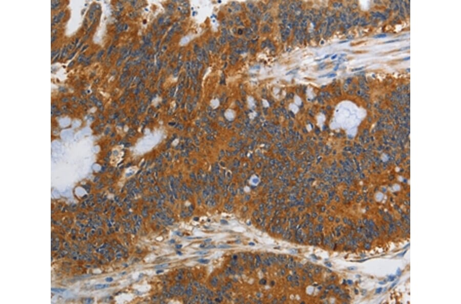 Immunohistochemistry - PIK3C3 Antibody from Signalway Antibody (37356) - Antibodies.com