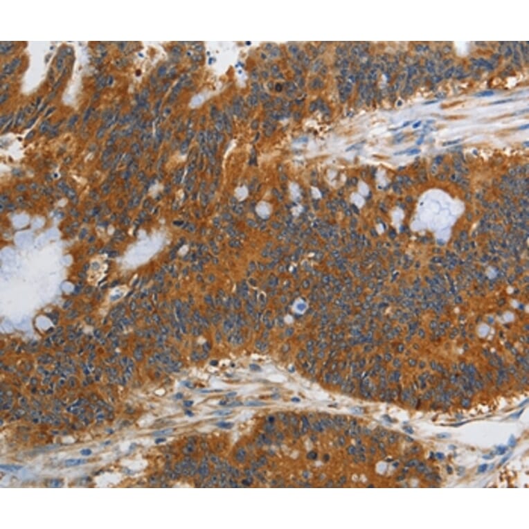 Immunohistochemistry - PIK3C3 Antibody from Signalway Antibody (37356) - Antibodies.com