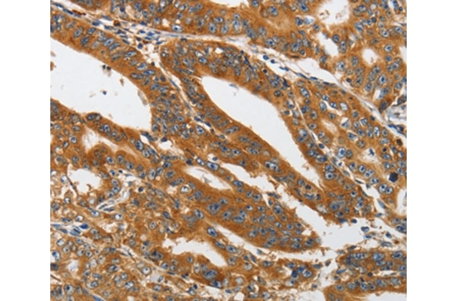 Immunohistochemistry - PIK3C3 Antibody from Signalway Antibody (37356) - Antibodies.com