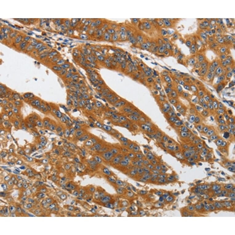 Immunohistochemistry - PIK3C3 Antibody from Signalway Antibody (37356) - Antibodies.com