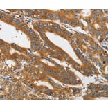 Immunohistochemistry - PIK3C3 Antibody from Signalway Antibody (37356) - Antibodies.com