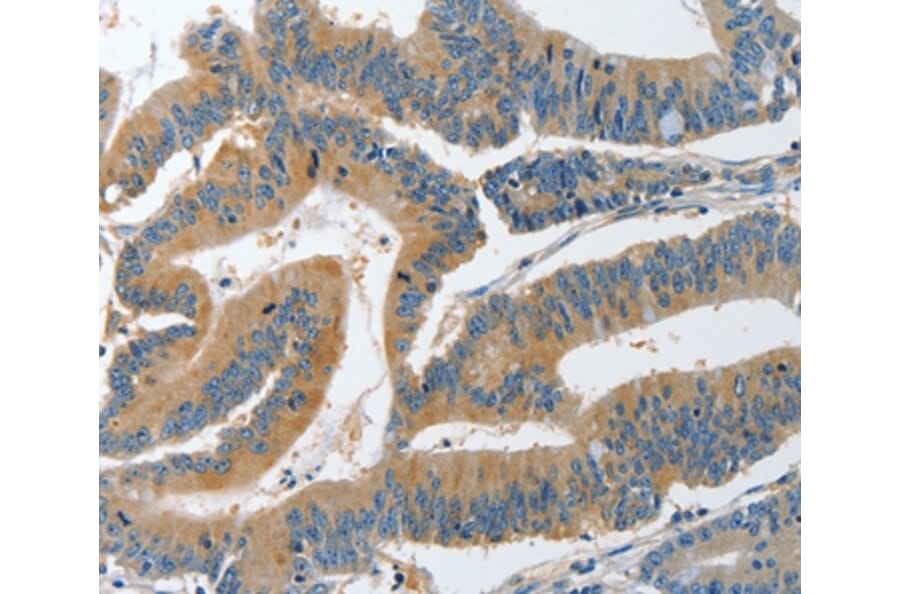 Immunohistochemistry - PIK3R4 Antibody from Signalway Antibody (37374) - Antibodies.com