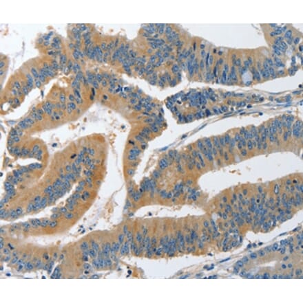 Immunohistochemistry - PIK3R4 Antibody from Signalway Antibody (37374) - Antibodies.com
