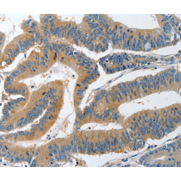Immunohistochemistry - PIK3R4 Antibody from Signalway Antibody (37374) - Antibodies.com