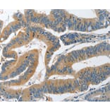 Immunohistochemistry - PIK3R4 Antibody from Signalway Antibody (37374) - Antibodies.com