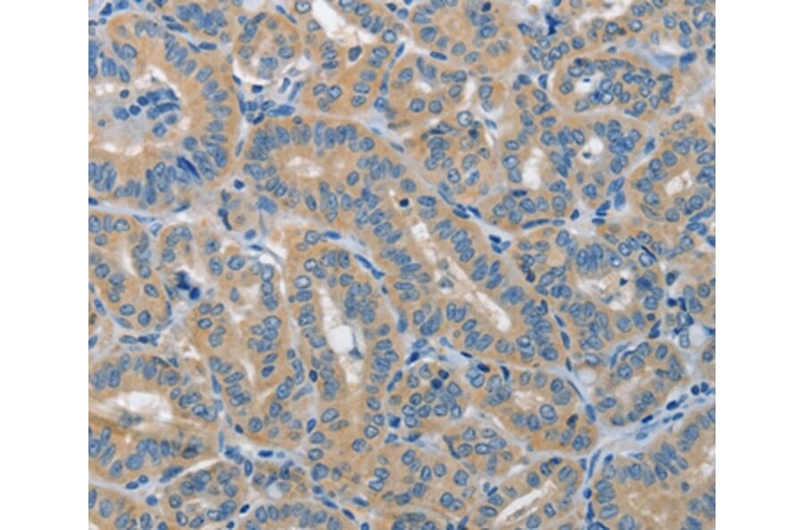 Immunohistochemistry - PIK3R4 Antibody from Signalway Antibody (37374) - Antibodies.com