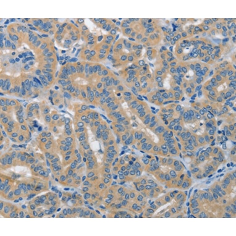 Immunohistochemistry - PIK3R4 Antibody from Signalway Antibody (37374) - Antibodies.com
