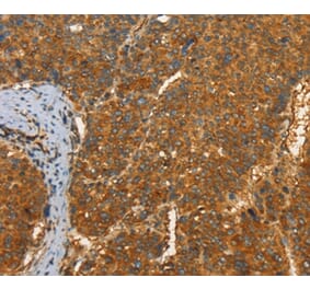 Immunohistochemistry - PFKFB1 Antibody from Signalway Antibody (37383) - Antibodies.com