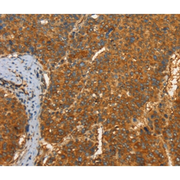 Immunohistochemistry - PFKFB1 Antibody from Signalway Antibody (37383) - Antibodies.com