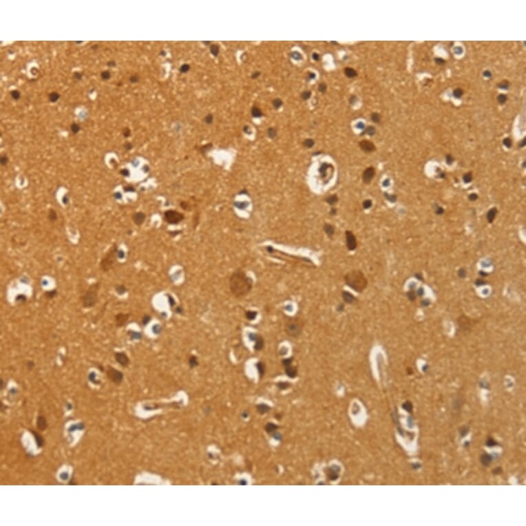 Immunohistochemistry - PFKFB1 Antibody from Signalway Antibody (37383) - Antibodies.com
