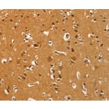 Immunohistochemistry - PFKFB1 Antibody from Signalway Antibody (37383) - Antibodies.com