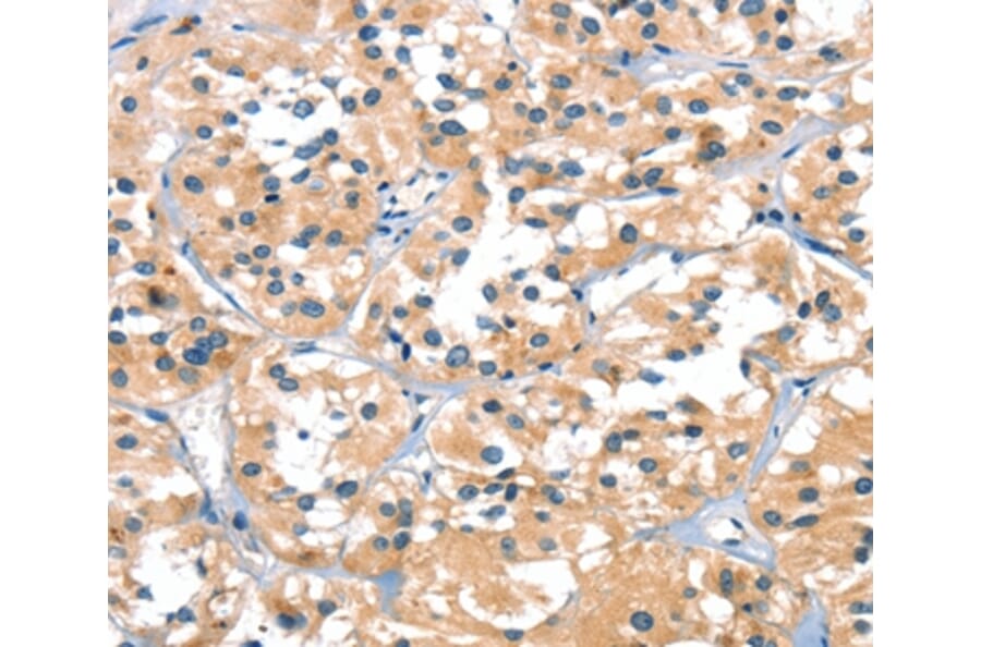 Immunohistochemistry - SLC6A4 Antibody from Signalway Antibody (37406) - Antibodies.com