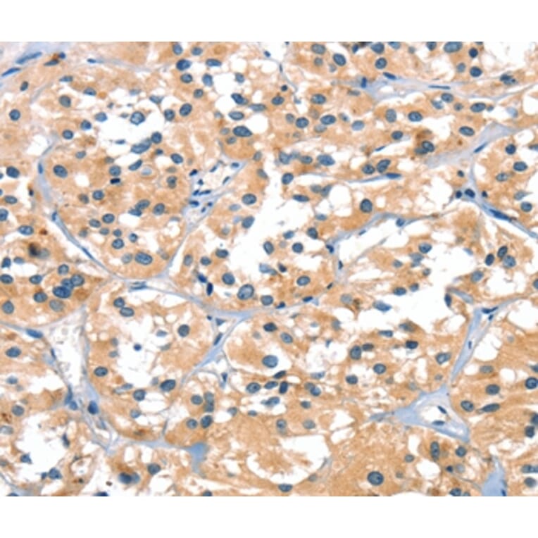 Immunohistochemistry - SLC6A4 Antibody from Signalway Antibody (37406) - Antibodies.com